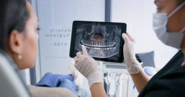 Licensed Tooth Extraction service in Raleigh, NC - Smile Center Dentistry